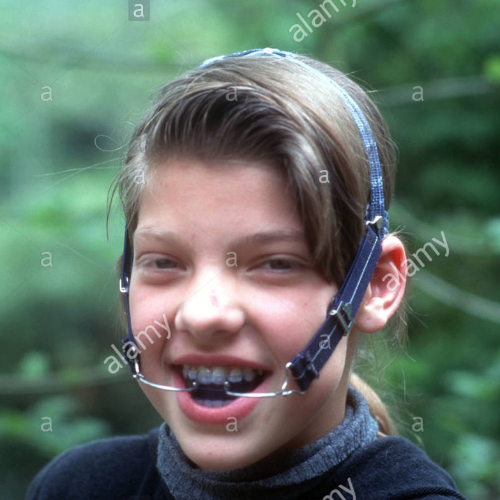 apr 24, 1822 braces headgear was made in the U.S (Timeline)